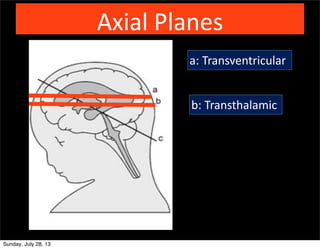 Axial	
  Planes
a:	
  Transventricular
b:	
  Transthalamic	
  
Sunday, July 28, 13
 