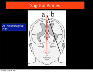 SagiZal	
  Planes	
  	
  
A:	
  The	
  Midsagittal	
  
Plan
Sunday, July 28, 13
 