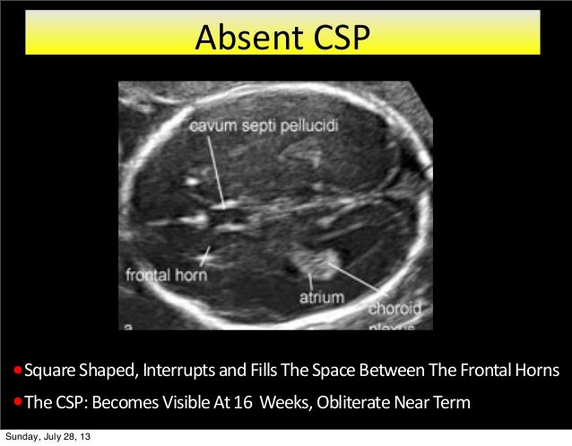 Fetal neurosonogram jucog feb 2013