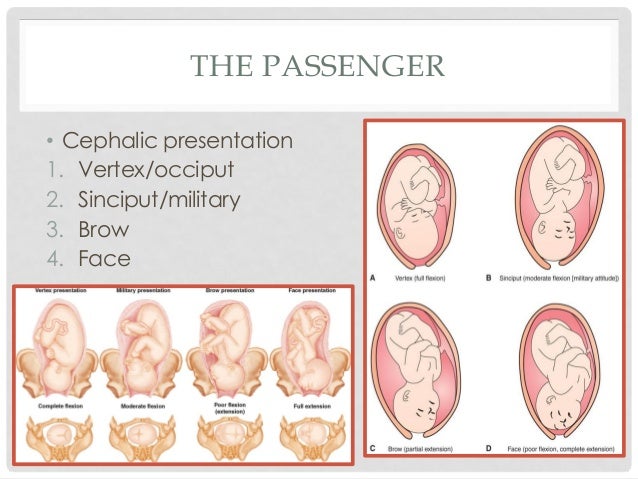 what are the three types of fetal presentation