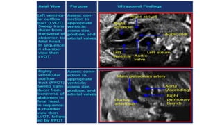 Fetal circulation