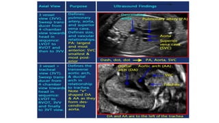 Fetal circulation