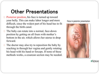 Other Presentations 
Posterior position, his face is turned up toward 
your belly. This can make labor longer and more 
difficult, since the widest part of his head has to fit 
through the birth canal. 
The baby can rotate into a normal, face-down 
position by getting on all fours with mother’s 
bottom in the air, which allows her uterus to drop 
forward. 
The doctor may also try to reposition the baby by 
reaching in through her vagina and gently rotating 
his head with his hand or forceps. If none of these 
methods works, a cesarean section may be needed. 
 