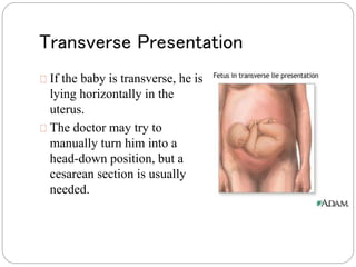 Transverse Presentation 
If the baby is transverse, he is 
lying horizontally in the 
uterus. 
The doctor may try to 
manually turn him into a 
head-down position, but a 
cesarean section is usually 
needed. 
 