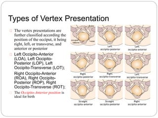 Types of Vertex Presentation 
The vertex presentations are 
further classified according the 
position of the occiput, it being 
right, left, or transverse, and 
anterior or posterior 
Left Occipito-Anterior 
(LOA), Left Occipito- 
Posterior (LOP), Left 
Occipito-Transverse (LOT); 
Right Occipito-Anterior 
(ROA), Right Occipito- 
Posterior (ROP), Right 
Occipito-Transverse (ROT); 
The Occipito-Anterior position is 
ideal for birth 
 