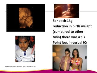 For each 1kg
reduction in birth weight
(compared to other
twin) there was a 13
Point loss in verbal IQ
Ref: Edmonds CJ et al. Pediatrics 2010;126:e1095–e1101
 
