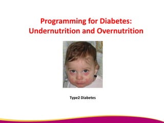 Programming for Diabetes:
Undernutrition and Overnutrition
Type2 Diabetes
 