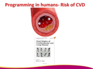 Programming in humans- Risk of CVD
 