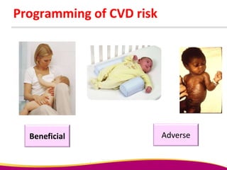 Programming of CVD risk
Beneficial Adverse
 