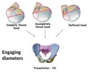 Fetal skull and it's diameters in obstetrics | PPTX