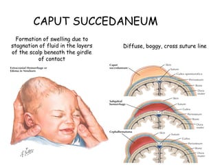 Fetal skull and it's diameters in obstetrics | PPTX