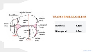 Biparietal 9.5cm
Bitemporal 8.2cm
TRANSVERSE DIAMETER
@KOUSHIK
 