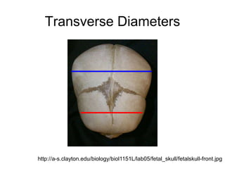 Transverse Diameters
http://a-s.clayton.edu/biology/biol1151L/lab05/fetal_skull/fetalskull-front.jpg
 
