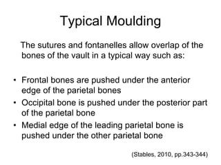 Typical Moulding
The sutures and fontanelles allow overlap of the
bones of the vault in a typical way such as:
• Frontal bones are pushed under the anterior
edge of the parietal bones
• Occipital bone is pushed under the posterior part
of the parietal bone
• Medial edge of the leading parietal bone is
pushed under the other parietal bone
(Stables, 2010, pp.343-344)
 