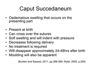 Caput Succedaneum
• Oedematous swelling that occurs on the
presenting part
• Present at birth
• Can cross over the sutures
• Soft swelling and will indent with pressure
• Decreases following delivery
• No treatment is required
• Will disappear approximately 24-48hrs after birth
• Moulding will also be apparent
(Burden and Sapsed, 2011, pp.388-389; Wylie, 2005, p.200)
 