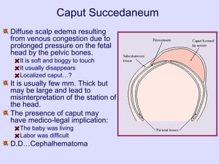 Caput Succedaneum
Diffuse scalp edema resulting
from venous congestion due to
prolonged pressure on the fetal
head by the pelvic bones.
It is soft and boggy to touch
It usually disappears
Localized caput…?
It is usually few mm. Thick but
may be large and lead to
misinterpretation of the station of
the head.
The presence of caput may
have medico-legal implication:
The baby was living
Labor was difficult
D.D…Cephalhematoma
 