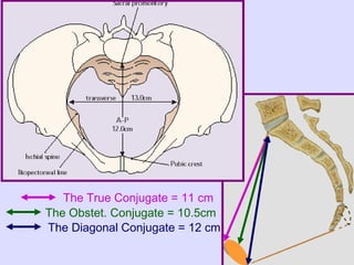 The True Conjugate = 11 cm
The Obstet. Conjugate = 10.5cm
The Diagonal Conjugate = 12 cm
 