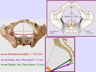 Interspinous diam. = 10.5 cm.
Obstet. Ant. Post diam= 13 cm.
Anato. Ant. Post diam= 11 cm.
 