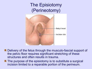 The Episiotomy
(Perineotomy)
Delivery of the fetus through the musculo-fascial support of
the pelvic floor requires significant stretching of these
structures and often results in trauma.
The purpose of the episiotomy is to substitute a surgical
incision limited to a reparable portion of the perineum.
 