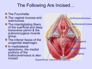 The Following Are Incised…
The Fourchette.
The vaginal mucosa and
submucosa.
The interdigitating fibers
of the suerficial and deep
transverse perinii & the
pubococcygeus muscle
group.
The inferior fascia of the
urogenital diaphragm.
In mediolateral
episiotomy, the medial
portions of the
bulbocavernosus is also
incised
ischiocavernosus
Bulbocavernosus
Pubococcygeus
Superficial transverse perinii
Iliococcygeus
Coccygeus
 