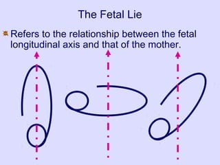 The Fetal Lie
Refers to the relationship between the fetal
longitudinal axis and that of the mother.
 