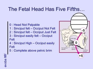 The Fetal Head Has Five Fifths…
0 : Head Not Palpable
1 : Sinciput felt – Occiput Not Felt
2 : Sinciput felt – Occiput Just Felt
3 : Sinciput easily felt – Occiput
Felt
4 : Sinciput High – Occiput easily
Felt
5 : Complete above pelvic brim
fifthabove
-5
0
+5
 