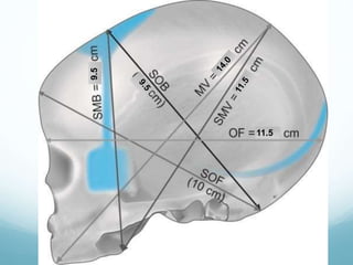 FETAL SKULL AND MATERNAL PELVIS (Dr. Utpala Mazumder).pptx