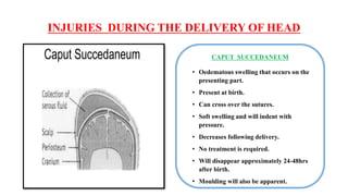 FETAL SKULL PPT .pptx
