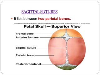 SAGITTAL SUTURES
 It lies between two parietal bones.
 