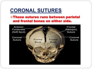 CORONAL SUTURES
These sutures runs between parietal
and frontal bones on either side.
 