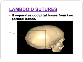 LAMBDOID SUTURES
 It separates occipital bones from two
parietal bones.
 
