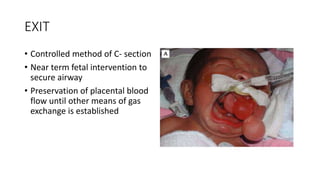 EXIT
• Controlled method of C- section
• Near term fetal intervention to
secure airway
• Preservation of placental blood
flow until other means of gas
exchange is established
 