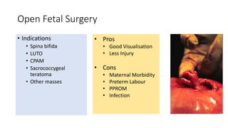 Open Fetal Surgery
• Indications
• Spina bifida
• LUTO
• CPAM
• Sacrococcygeal
teratoma
• Other masses
• Pros
• Good Visualisation
• Less Injury
• Cons
• Maternal Morbidity
• Preterm Labour
• PPROM
• Infection
 