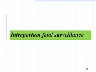 Intrapartum fetal surveillance
32
 