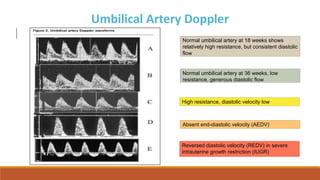 approach to evidence based antenatal Fetal survelliance | PPTX