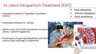 Ex Utero Intrapartum Treatment (EXIT)
• Operation based On Placental Circulation
(OOPS)
• Controlled method of C- Section
• Allows a near term fetal intervention to secure
airway – prevent hypoxemia
• Preservation of placental blood flow until other
means of gas exchange is established
 Fetal relaxation
 Uterine relaxation
 Fetal anesthesia
 