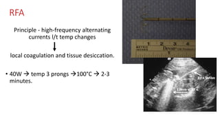 RFA
Principle - high-frequency alternating
currents l/t temp changes
local coagulation and tissue desiccation.
• 40W  temp 3 prongs 100°C  2-3
minutes.
 