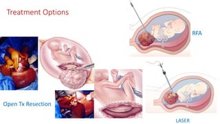 Treatment Options
Open Tx Resection
RFA
LASER
 