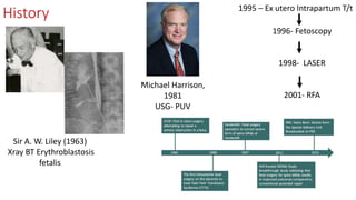History
Sir A. W. Liley (1963)
Xray BT Erythroblastosis
fetalis
1995 – Ex utero Intrapartum T/t
Michael Harrison,
1981
USG- PUV
1996- Fetoscopy
1998- LASER
2001- RFA
 