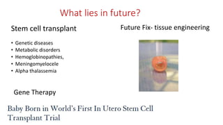 What lies in future?
Stem cell transplant
• Genetic diseases
• Metabolic disorders
• Hemoglobinopathies,
• Meningomyelocele
• Alpha thalassemia
Future Fix- tissue engineering
Gene Therapy
 
