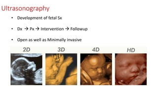 Ultrasonography
• Development of fetal Sx
• Dx  Px  Intervention  Followup
• Open as well as Minimally invasive
 