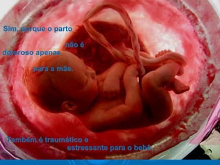 Sim, porque o partoSim, porque o parto
não énão é
doloroso apenasdoloroso apenas
para a mãe.para a mãe.
Também é traumático eTambém é traumático e
estressante para o bebê.estressante para o bebê.
 