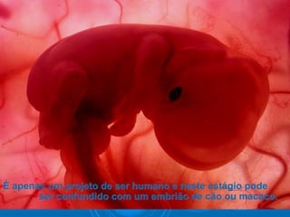 É apenas um projeto de ser humano e neste estágio podeÉ apenas um projeto de ser humano e neste estágio pode
ser confundido com um embrião de cão ou macaco.ser confundido com um embrião de cão ou macaco.
 