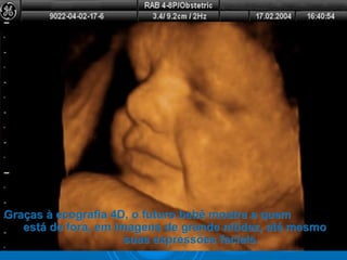 Graças à ecografia 4D, o futuro bebê mostra a quemGraças à ecografia 4D, o futuro bebê mostra a quem
está de fora, em imagens de grande nitidez, até mesmoestá de fora, em imagens de grande nitidez, até mesmo
suas expressões faciais.suas expressões faciais.
 