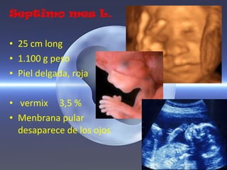 Septimo mes L.

• 25 cm long
• 1.100 g peso
• Piel delgada, roja

• vermix 3,5 %
• Menbrana pular
  desaparece de los ojos
 