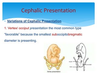 cephalic presentation slideshare