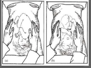 IN UTERO MEDICAL DEFINITION visual data 8