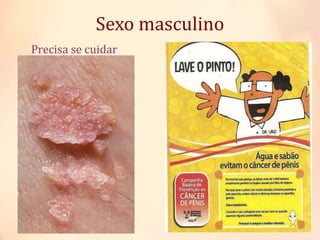 Precisa se cuidar
Sexo masculino
 