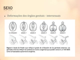 Deformações dos órgãos genitais - intersexuais
 