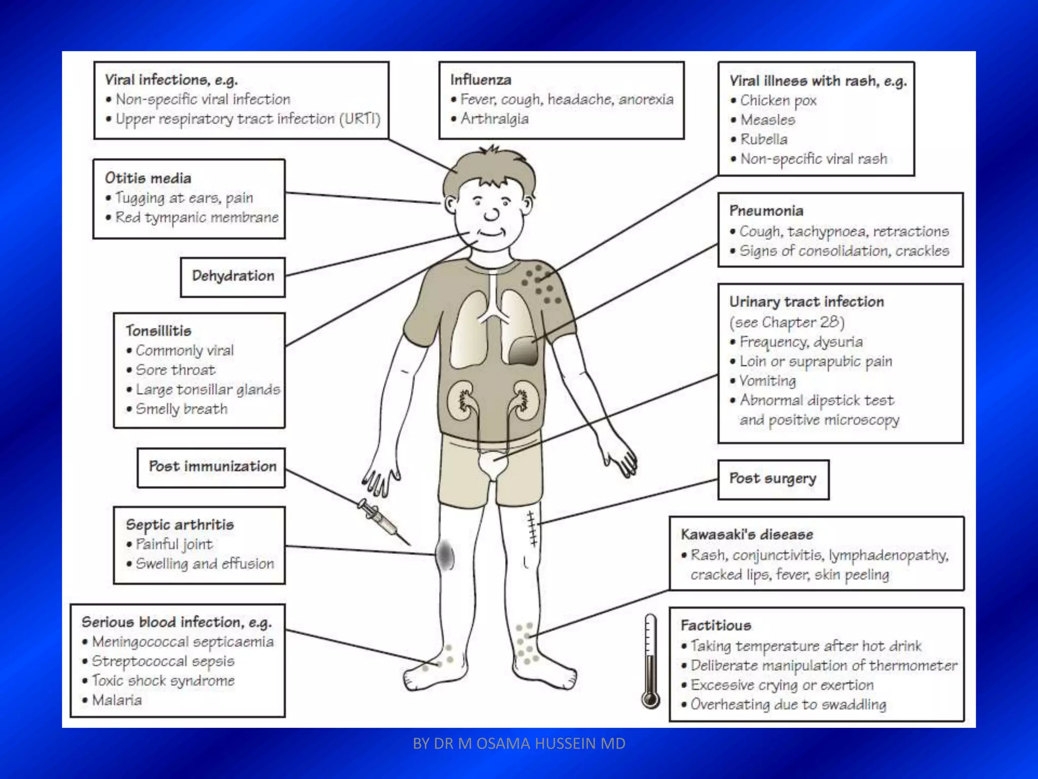BY DR M OSAMA HUSSEIN MD
 